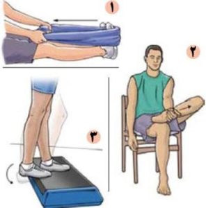 درمان عارضه «کف پای گود» با چند حرکت اصلاحی