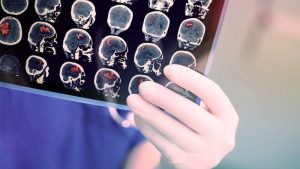 هشدار درباره پایین آمدن سن بروز سرطان در خوزستان